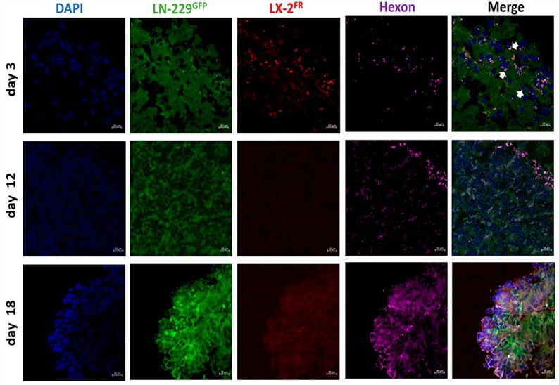 Immunofluorescence staining is used to observe the expression of related proteins. (OA Literature)